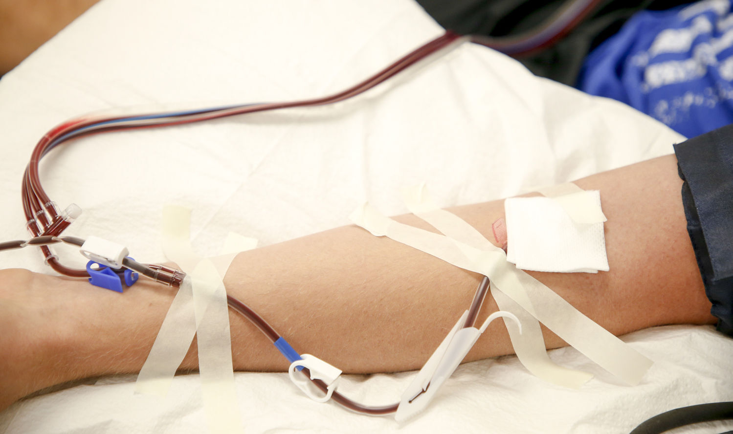 Convalescent serum therapy
